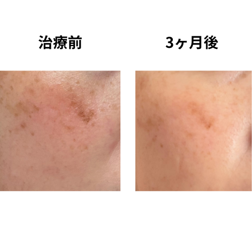 3ヶ月目