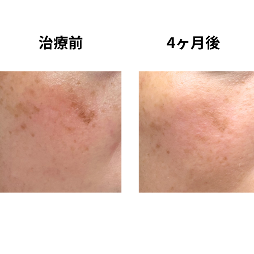 4ヶ月目